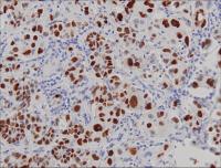 Universal UltraPolymer Cocktail, Goat anti-Rabbit/Mouse IgG (H&L) conjugated to HRP, affinity purified